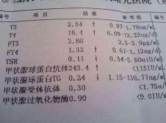 教你如何三分钟看懂甲功5项化验单结果？